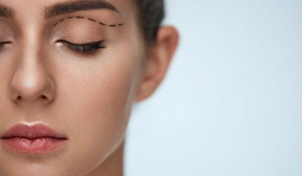 When Is Blepharoplasty Right for You?