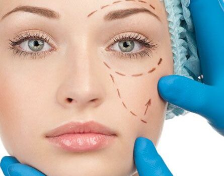 Should You Get A Cheek Lift With Your Eyelid Surgery?