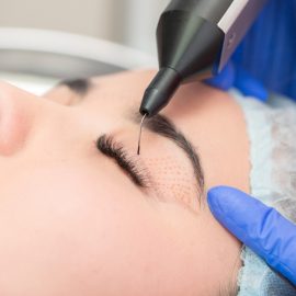 woman getting ptosis surgery